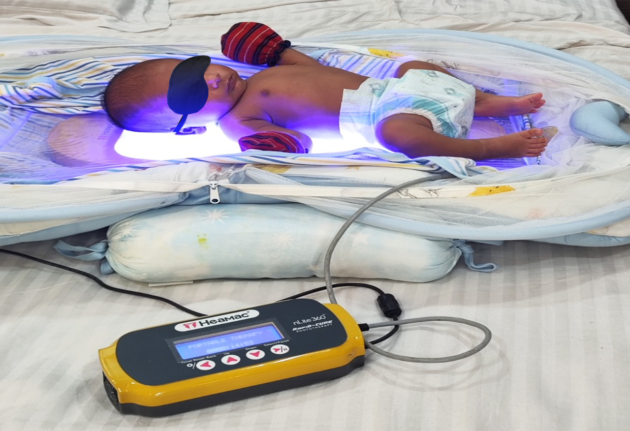 Heamac Phototherapy Device